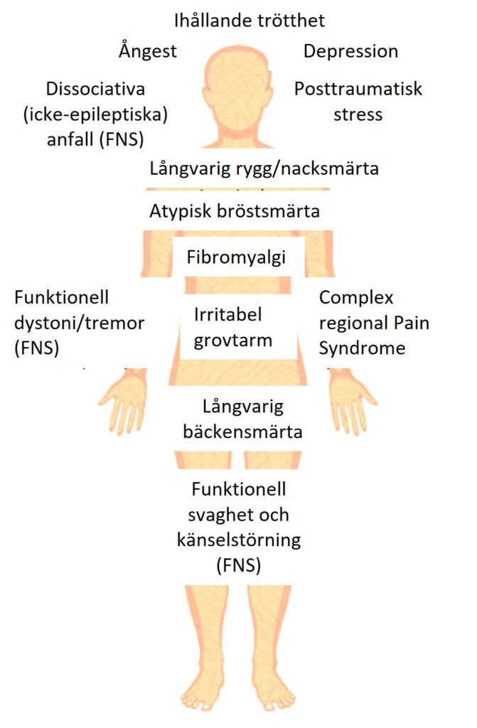 Andra Symtom Ibs Dyspepsi Bröstsmärta Functional Neurological